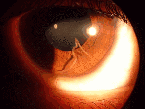 20220419854366.gif 4.192.gif