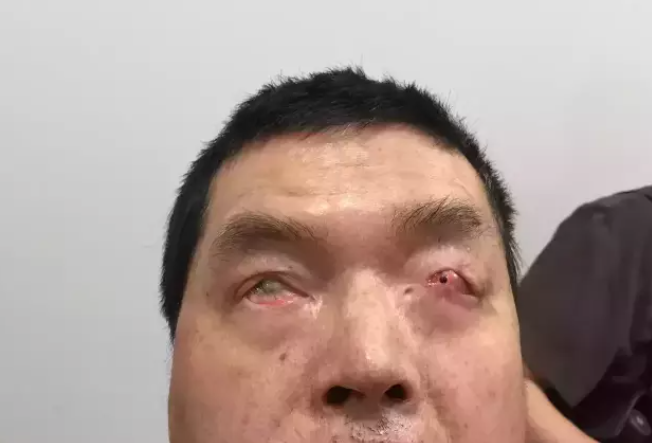 20220511848521.png 11.png