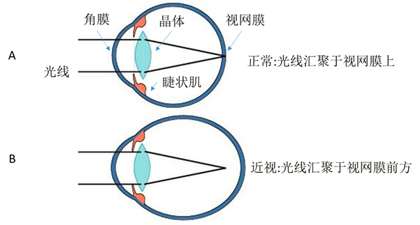 20220526181703.png 3.png