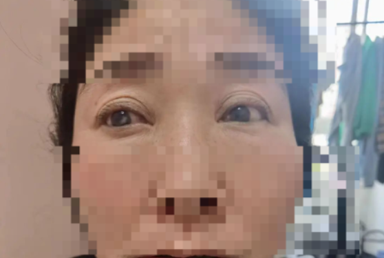 20220602538998.png image.png