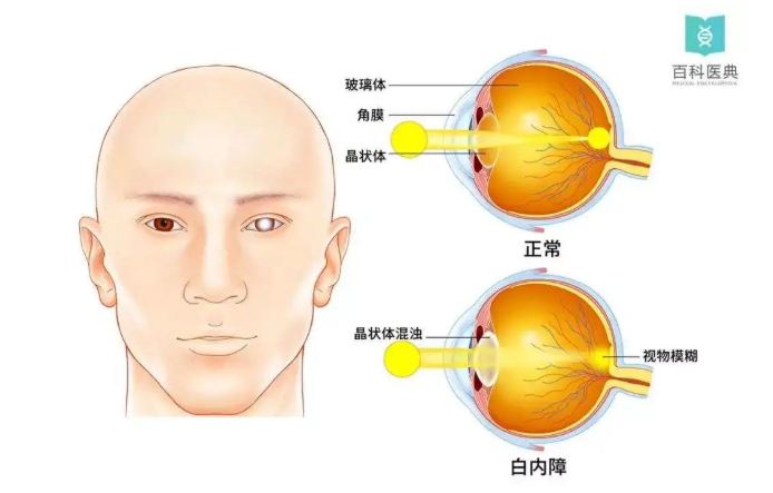 20220810163008.png 4.png