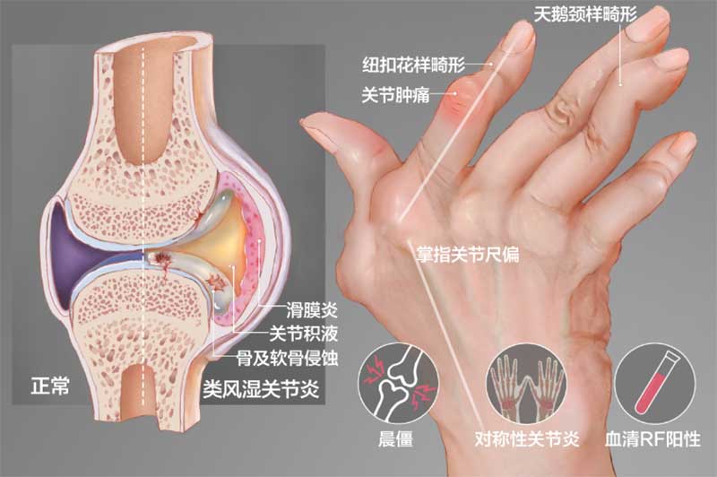关节.jpg